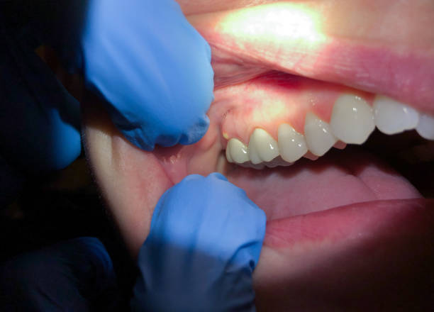 Best Emergency Dentist for Knocked-Out Tooth in Garden Acres, CA